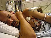 Marc Having Pheresis
