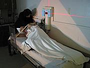 Total Body Irradiation at UCLA